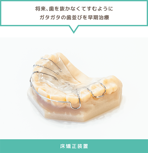 「将来、歯を抜かなくてすむようにガタガタの歯並びを早期治療」床矯正装置
